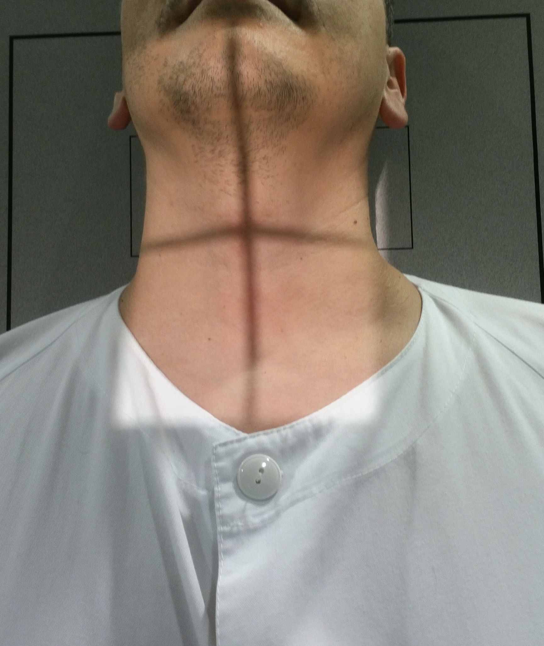 Diagrama AP Cervical